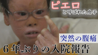 乾燥で皮膚にダメージも…ゲームに影響は?~配信型ドキュメンタリー「ピエロと呼ばれた息子」第141話